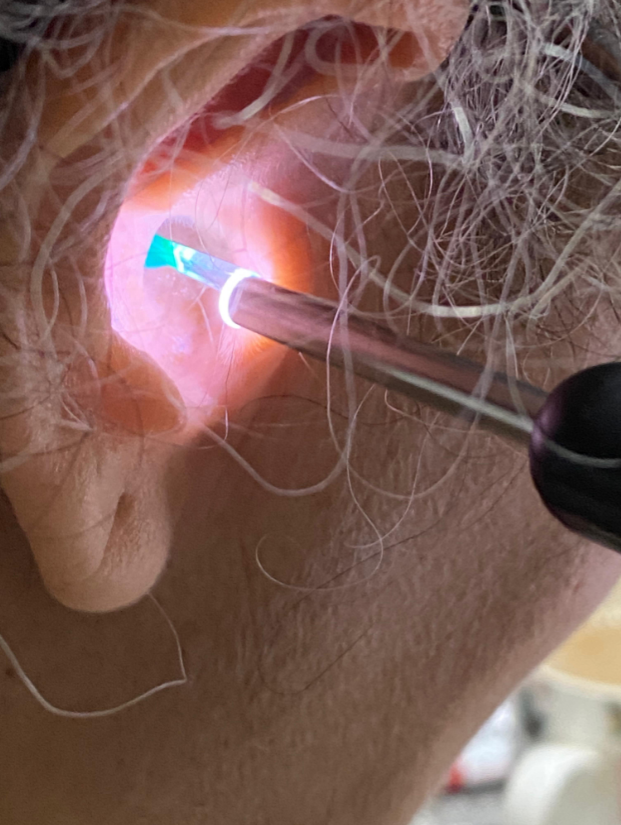 Cámara Limpiadora de Oídos con Cámara HD